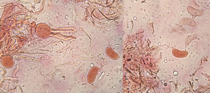 Globulisebacina badioumbrina sporyy